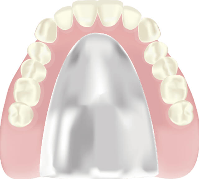 コバルトクロム床義歯