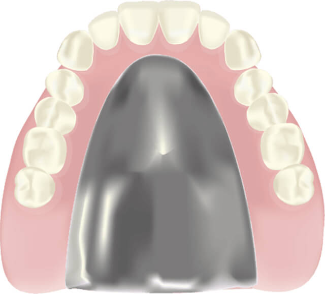 チタン床義歯